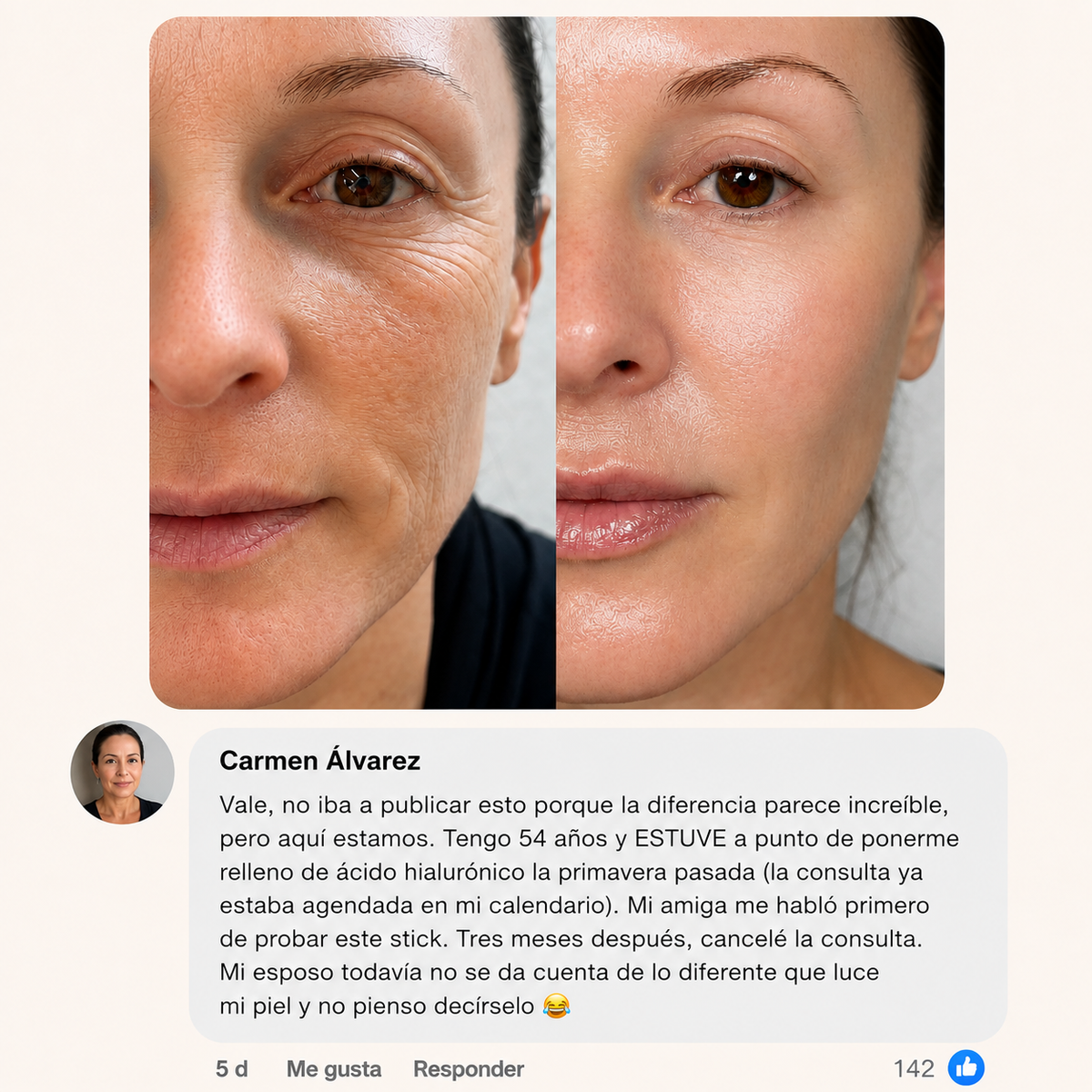 MULTI Bálsamo de Colágeno Volumen y Brillo Sin Agujas
