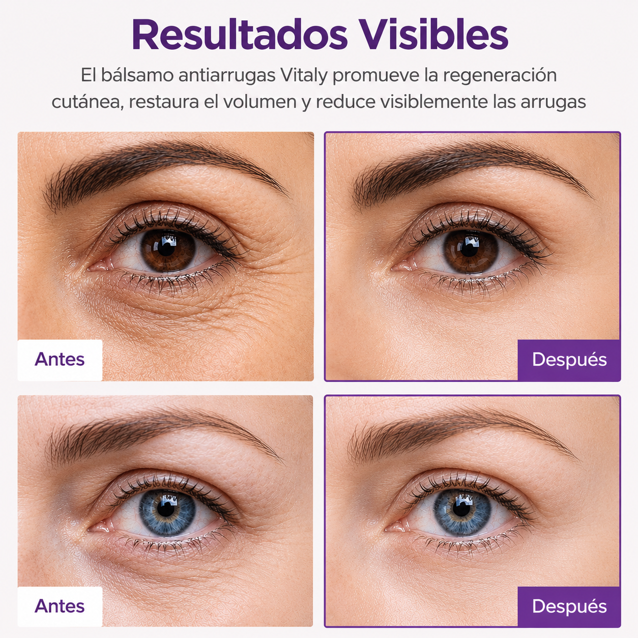 Vitalis Bálsamo Antiarrugas Hidratante- Piel mas firme y joven desde las primeras aplicaciones