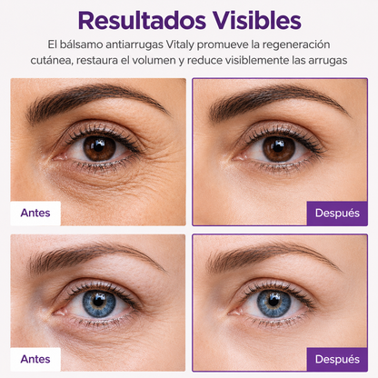 Vitalis Bálsamo Antiarrugas Hidratante- Piel mas firme y joven desde las primeras aplicaciones