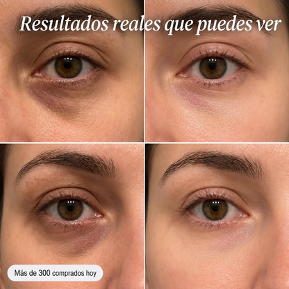 MULTI Bálsamo de Colágeno Volumen y Brillo Sin Agujas